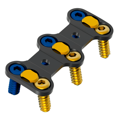 MIRACH Cervical Plate – Mikron Medical