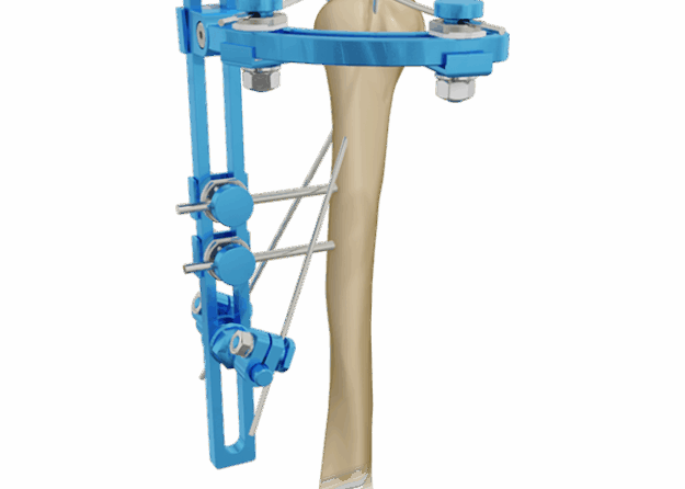 FEP SHOULDER – MIKAI