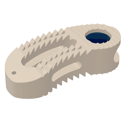 TUREIS Tlif Cage – Mikron Medical